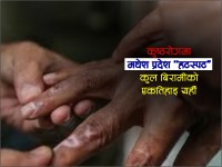 मधेशमा सबैभन्दा बढी कुष्ठरोगी, कुल बिरामीको एकतिहाइभन्दा बढी