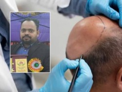कपाल प्रत्यारोपणकै क्रममा इन्जिनियरको मृत्यु, डाक्टरविरुद्ध मुद्दा