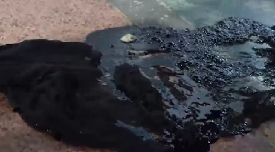 निशाना सौता, शिकार निर्दोष: कपडाको रङ झुक्किँदा गुरुग्राममा अर्कैमाथि 'एसिड' प्रहार