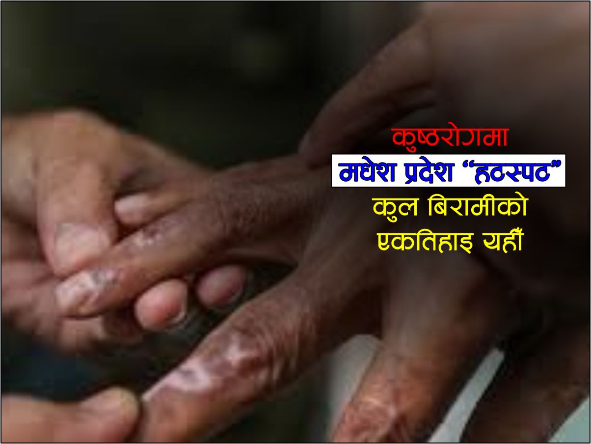 मधेशमा सबैभन्दा बढी कुष्ठरोगी, कुल बिरामीको एकतिहाइभन्दा बढी